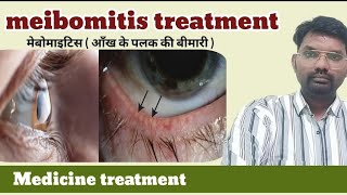 meibomitis treatment  meibomitis eye drops  meibomitis symptoms  meibomitis lid hygiene [upl. by Gerick369]