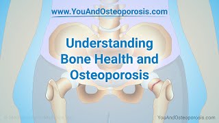 Understanding Bone Health and Osteoporosis [upl. by Ramal198]