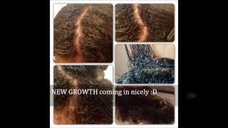 My Natural Hair Journey TEXTURIZER to NATURAL [upl. by Atile753]