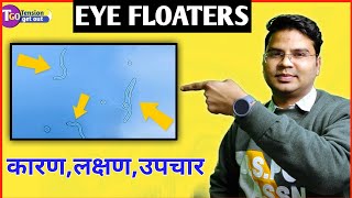 EYE FLOATERS  EYE FLASHES  LOKESH DIXIT  TENSION GET OUT [upl. by Pauwles]