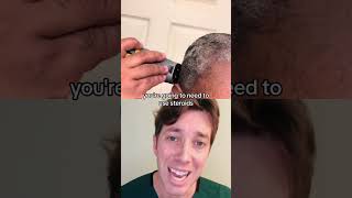 How to Get Rid of Dandruff  Seborrheic Dermatitis [upl. by Aleiram]