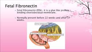 Preterm Labour [upl. by Anirdna]