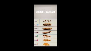 7 Stool Types With Explanation [upl. by Croix599]