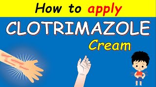 Clotrimazole cream Lotrimin How to apply  Uses and Side effects [upl. by Eitsirhc]