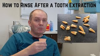 How to rinse gently after dental surgery [upl. by Nolaj]