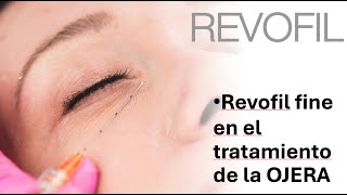 Como abordar las OJERAS con REVOFIL FINE [upl. by Wittie]