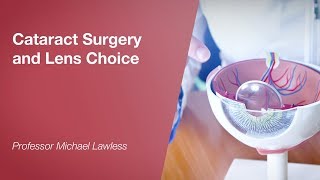 Cataract Surgery and Lens Choice [upl. by Chin910]