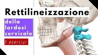 Rettilineizzazione della lordosi cervicale 3 esercizi [upl. by Ahseinek]