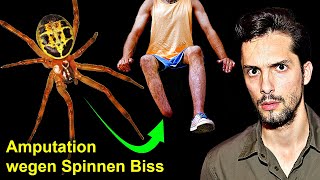 GiftSpinne in Deutschland verursacht Amputationen  Biologe klärt auf [upl. by Gilmore58]