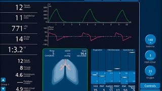 How does a ventilator works [upl. by Jabe]