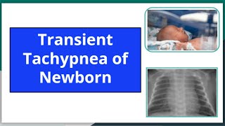 Transient tachypnea of newborn mbbs newbornneonatology neetpg pediatrics nursing ttn [upl. by Ainattirb]