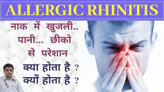 What is Allergic Rhinitis नाक में खुजलीपानी छीको से परेशान  cause symptoms Diagnosis [upl. by Maurer387]