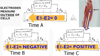 Electromyography EMG Biopac lecture [upl. by Karon99]