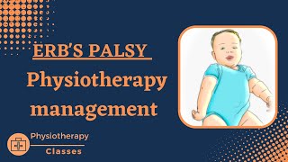 Erbs palsy physiotherapy managementphysical therapy for erbs palsyerbs paralysispt management [upl. by Aldon]