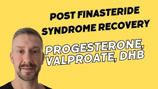 Post Finasteride Syndrome Recovery  Progesterone Valproate DHB [upl. by Swerdna]