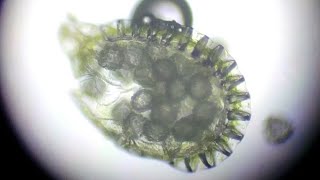 Pteridophyta fern  spores under a microscope  Tech microorganisms [upl. by Anaizit]