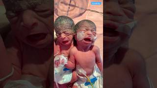 Newborn baby video medical viralvideo [upl. by Bessy]