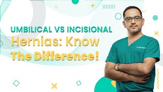 Umbilical vs incisional Hernia  Know the Difference  Mykare Health [upl. by Jemena]