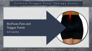 IlioPsoas Pain and Trigger Points [upl. by Aviva]