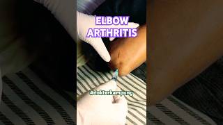 ELBOW ARTHRITIS  syarhan ruralhealthcare [upl. by Ianteen]