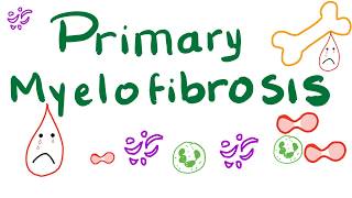 Primary Myelofibrosis PMF  Myeloproliferative Neoplasm Bone Marrow Fibrosis [upl. by Aisayt194]