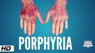 Porphyria Causes Signs and Symptoms Diagnosis and Treatment [upl. by Lerred]