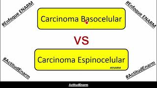 Carcinoma basocelular  Carcinoma espinocelular ENARM [upl. by Ailekat7]