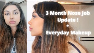 3 Month Nose Job Rhinoplasty Update  Everyday Makeup Turkey Nose Job [upl. by Amandi]