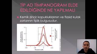 ODYOLOJİDE TİMPANOMETRİK TESTLER VE DEĞERLENDİRİLMELERİ [upl. by Leunammi]