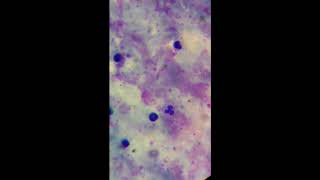 malaria parasites field stain [upl. by Ancell239]