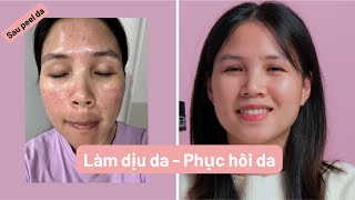 Làm dịu da sau nặn mụn Peel  Phục hồi da nhạy cảm Kem dưỡng ẩm Klairs Midnight Blue Calming Cream [upl. by Wsan]