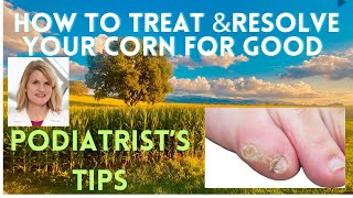 Podiatrist shares effective painrelieving corn on toe treatment and resolving the corn for good [upl. by Netti]