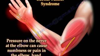 Cubital Tunnel Syndrome Ulnar Nerve Entrapment  Everything You Need To Know  Dr Nabil Ebraheim [upl. by Aurora99]