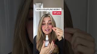 Does volufiline work for under eye hollows volufiline volufilineserum 1 [upl. by Acinonrev965]