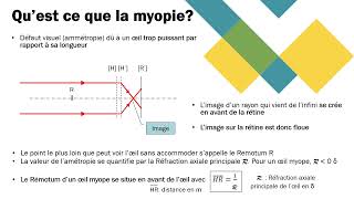 La myopie [upl. by Wald]