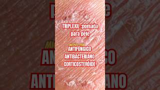 Triplexil clotrimazole batametasona gentamicina pomada cuidadoscomapele antifugico Saude [upl. by Tewfik]