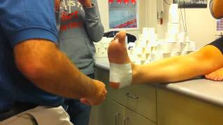 Acute Calcaneal Periostitis  Basket Weave Taping Technique [upl. by Aneeuq499]