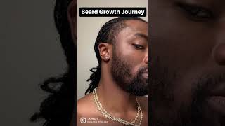 BEARD GROWTH 6 MONTH TRANSFORMSTION [upl. by Wilson]