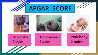 APGAR Score in newborn mbbs newbornAPGAR NewbornAssessment neetpg pediatrics nursingexam [upl. by Nolie574]