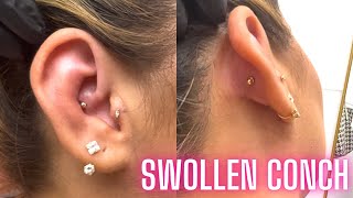 Jonys Vlog 008 Removing Swollen conch [upl. by Gladdie]