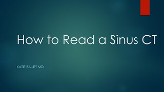 How to read a Sinus CT [upl. by Uah]