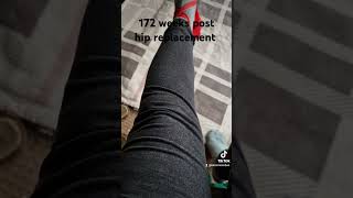 172 weeks post hip replacement quadisolation physio hipdysplasia hiprelacement [upl. by Manheim]