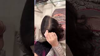 How TO Cover Up Hair Thinning Without Using Extensions  Hair Thinning Solutions For Women shorts [upl. by Abernathy]