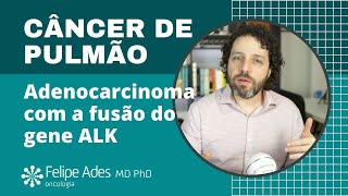 ALK POSITIVO  Câncer de pulmão com fusão do gene ALK como tratamos [upl. by Giah]