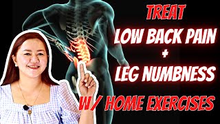 Treating Lumbar Spondylosis with Home Exercises  Doc Cherry [upl. by Calise240]