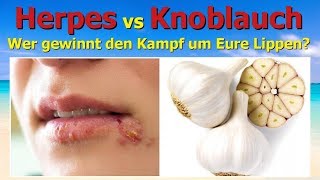 Herpes gegen Knoblauch  wer gewinnt den Kampf um Eure Lippen [upl. by O'Neil]