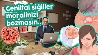 GENİTAL SİĞİL💥 TEDAVİSİ Siğil nasıl bulaşır Belirtileri nedir Kesin tedavisi var mı Siğil aşısı [upl. by Draner81]