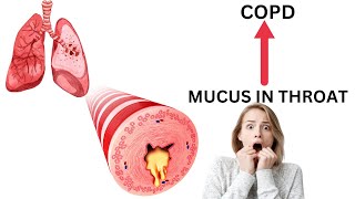 The 4 Causes Of Constant Mucus In Your Throat  Inspired By Dr Eric Berg DC [upl. by Gisser]