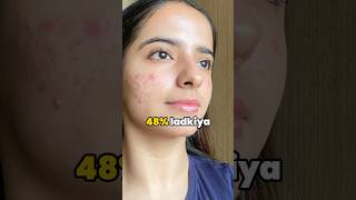 Pimples hote hai makeup lagana se youtubeshorts [upl. by Ssew]