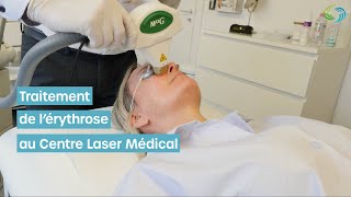 Avant et Après  Vaincre la Rosacée avec le MaxG lumière pulsée vasculaire chez Nutriesthétic Liège [upl. by Saxela]